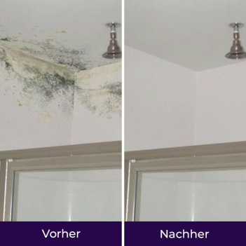 NuroClean image
